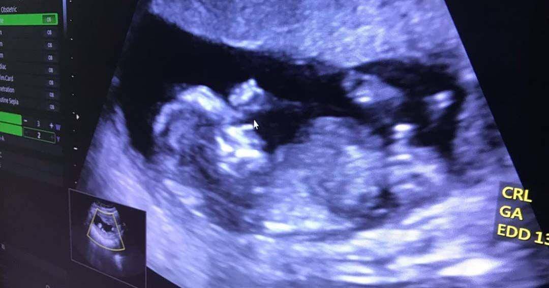 Instagram.com/Bibyalraen13