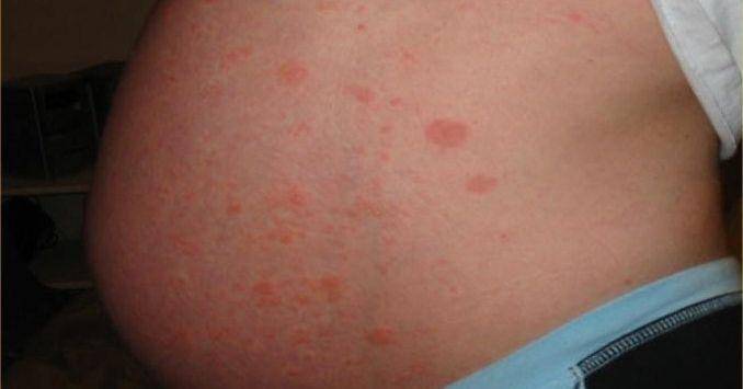 Commons.wikimedia.org