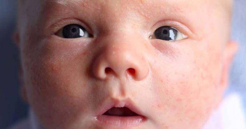 medicalnewstoday.com