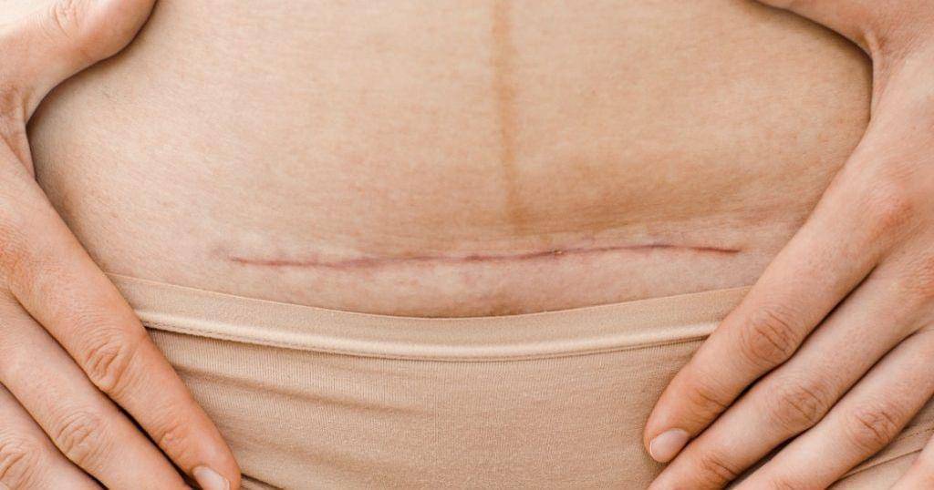 Stressfreemommies.com