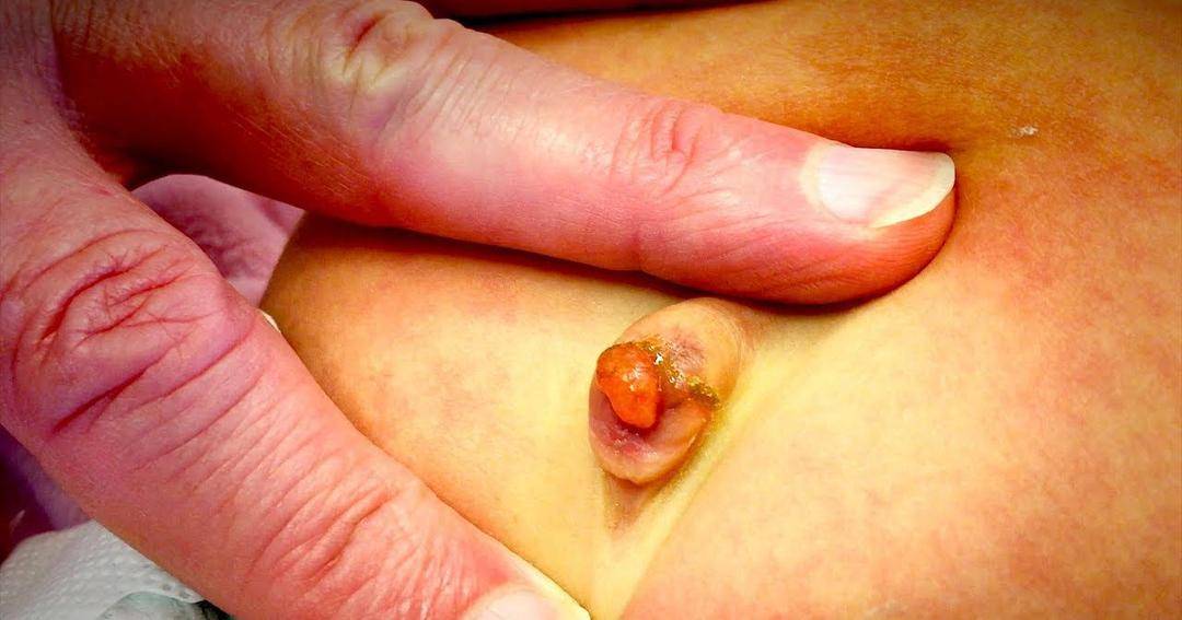 Youtube.com/Paulthomasmd