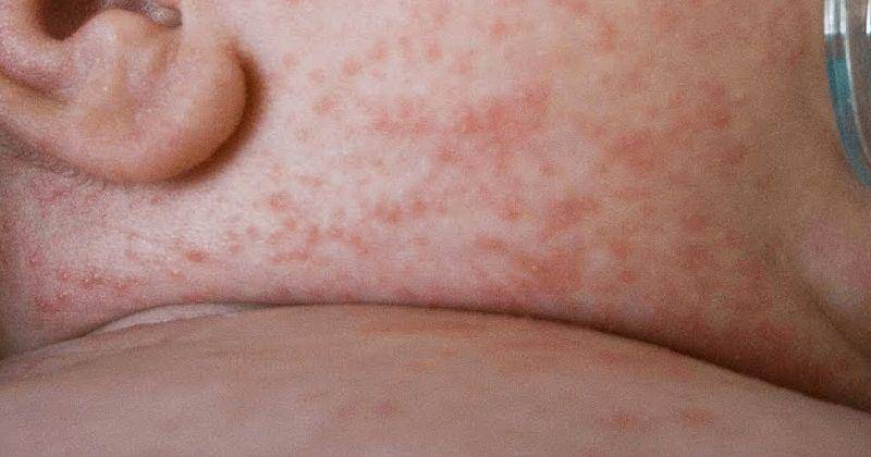 Youtube/doctor'scircle