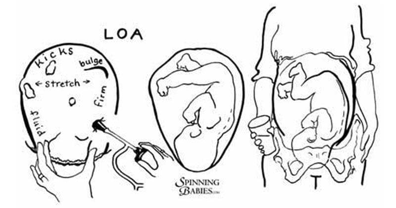 Pinterest.com/Spinning Babies