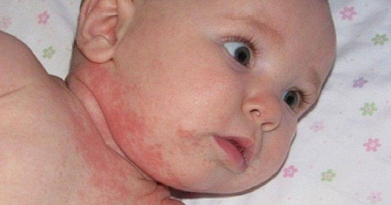 Youtube/healthinfotalk