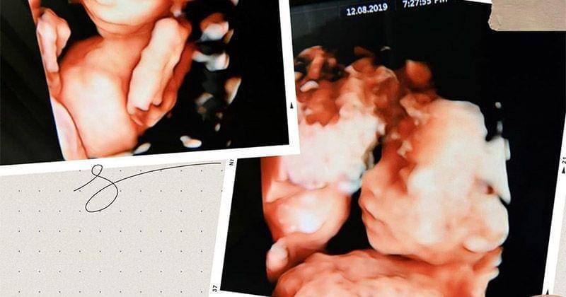 Instagram.com/_irishbella_