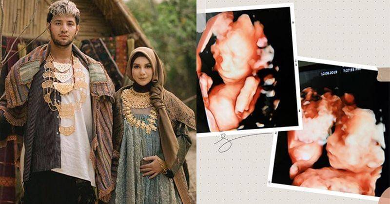 Instagram.com/_irishbella_