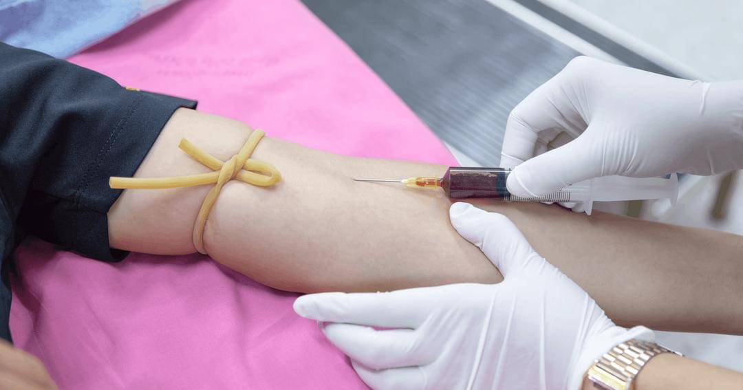 Pexels/Amornthep Srina