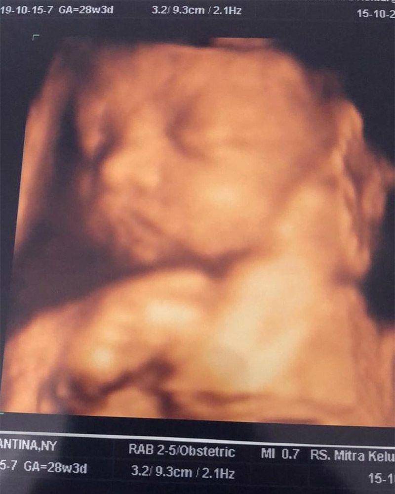 Instagram.com/young_lex18