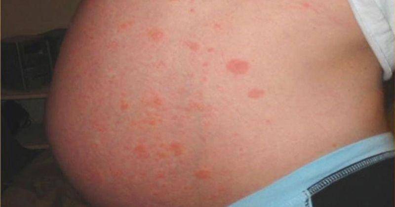 Medicalnewstoday.com