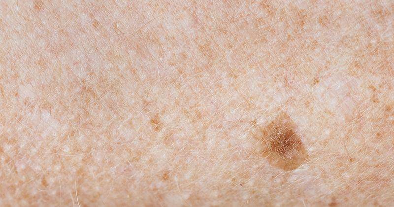 Freepik/Rawpixel.com