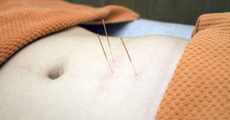 pixabay/Alterio Felines