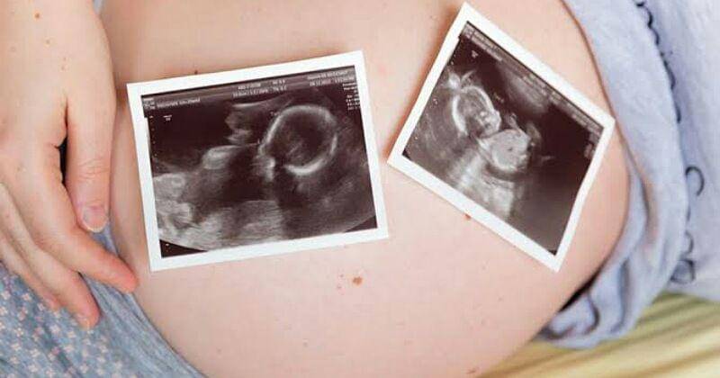 parenting.firstcry.com