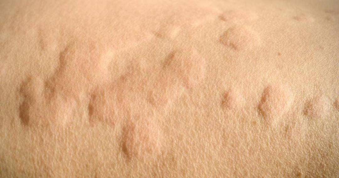 medicalnewstoday.com