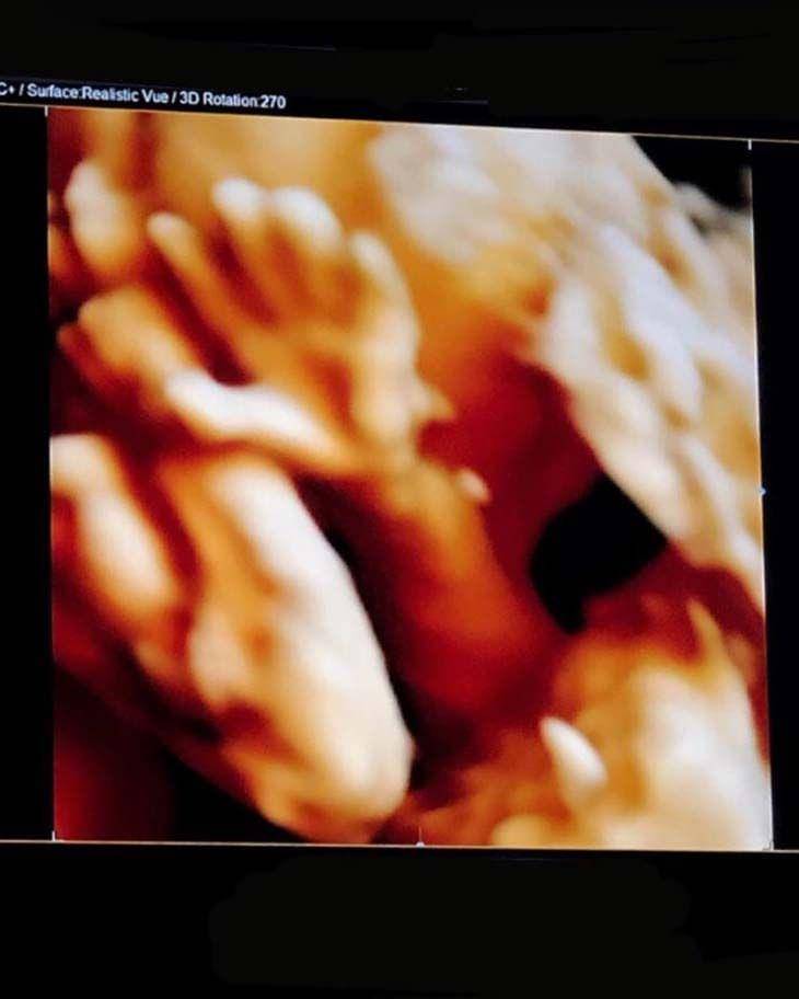 Instagram/edrictjandra