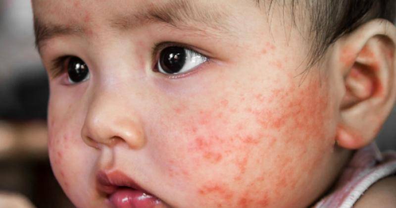 ilustrasi - vipleyo.com