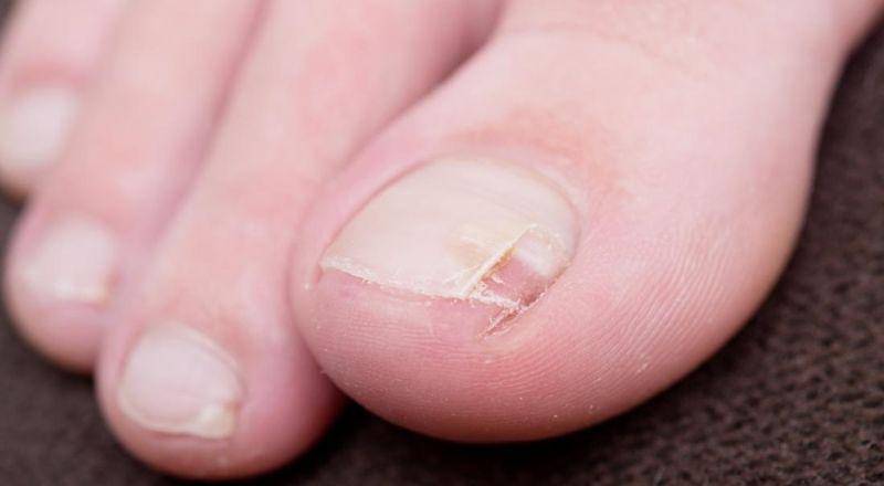 medicalnewstoday.com