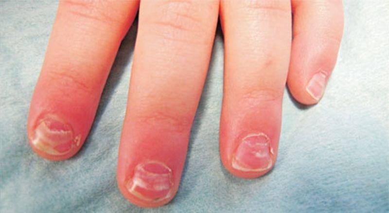 indianpediatrics.net