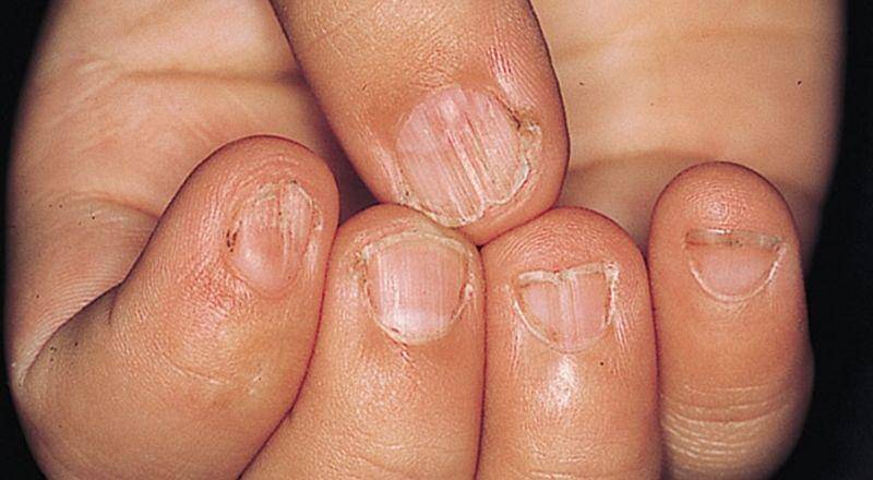 medicalpicturesinfo.com