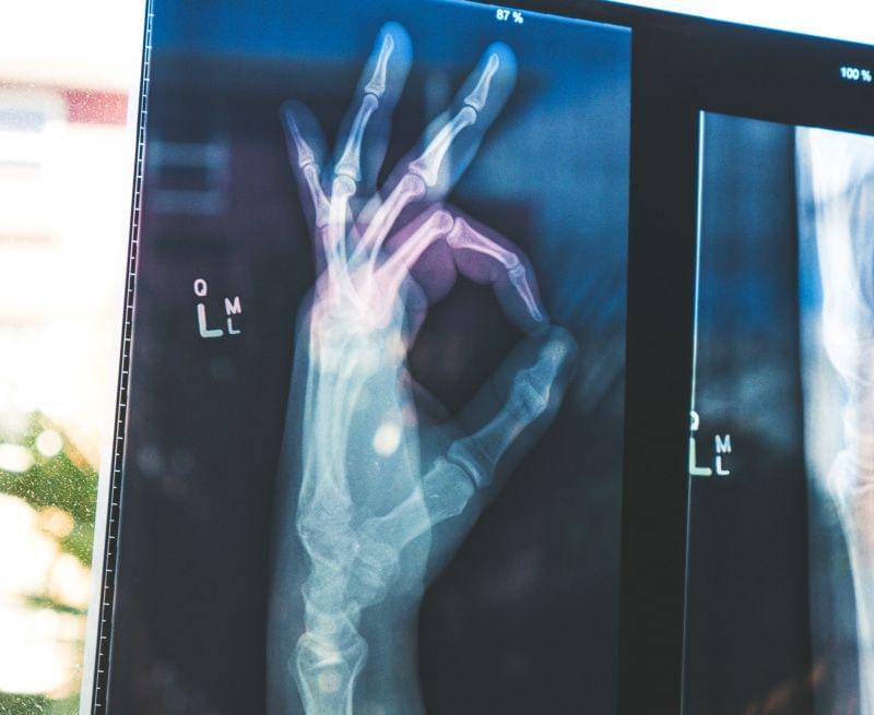 Ilustrasi kepadatan tulang yang mumpuni