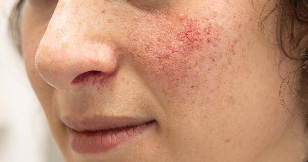 themarketherald.com.au