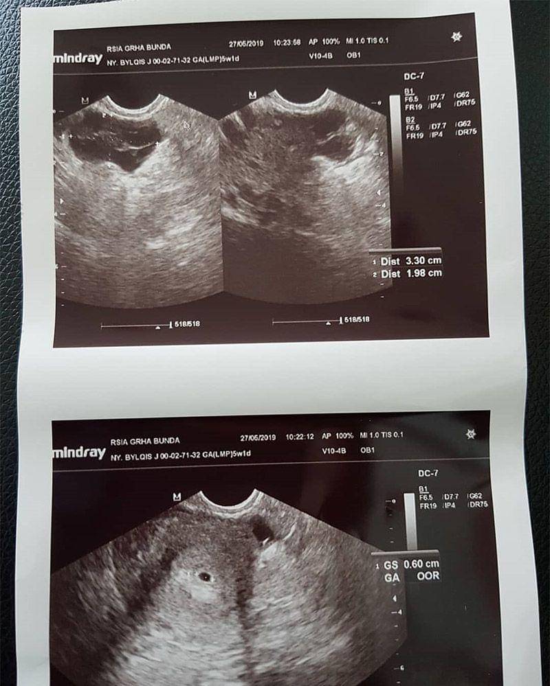 Instagram.com/markoesharison81