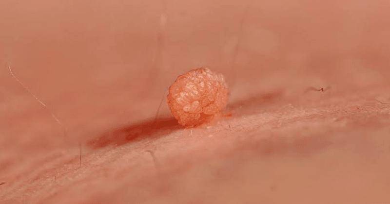 Medicalnewstoday.com