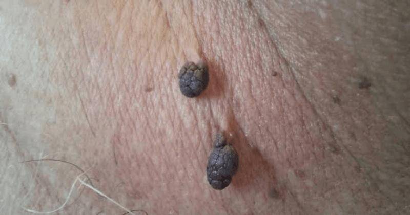 Medicalnewstoday.com