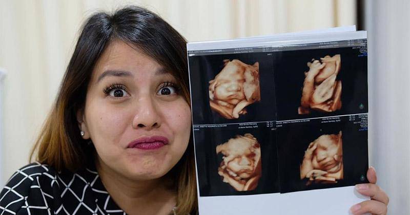 Instagram.com/tya_ariestya   