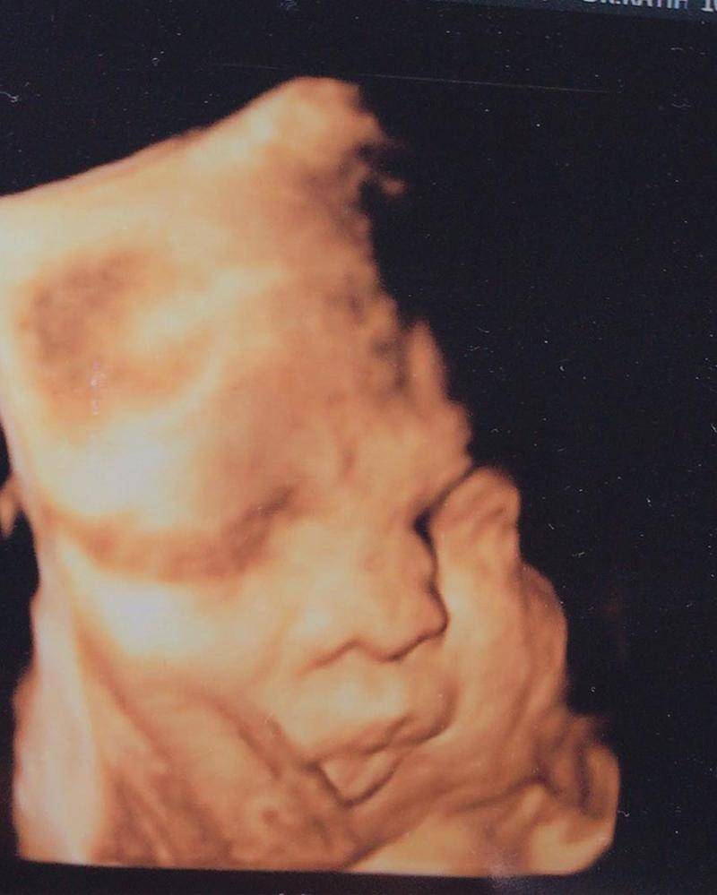 Instagram.com/tikabravani