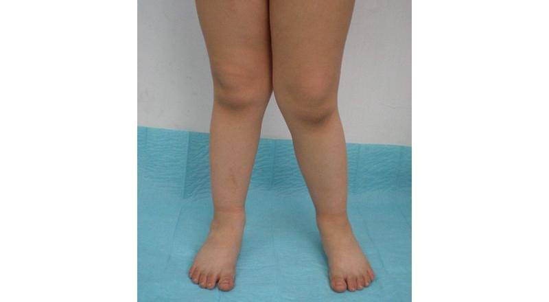 orthopedicsindia.com