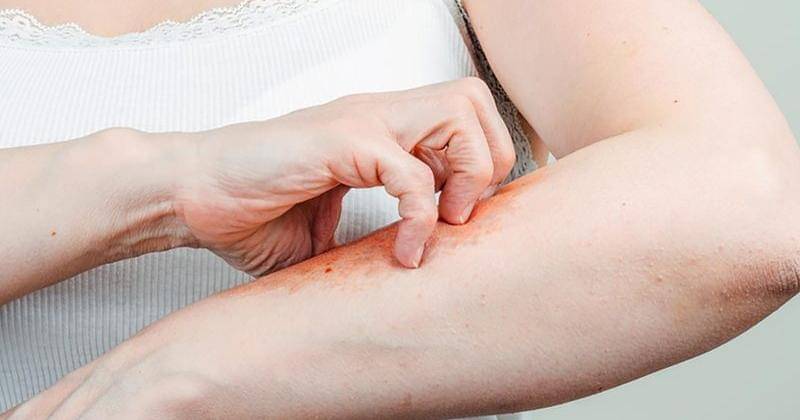 thehealthy.com/DJTaylor/Shutterstock