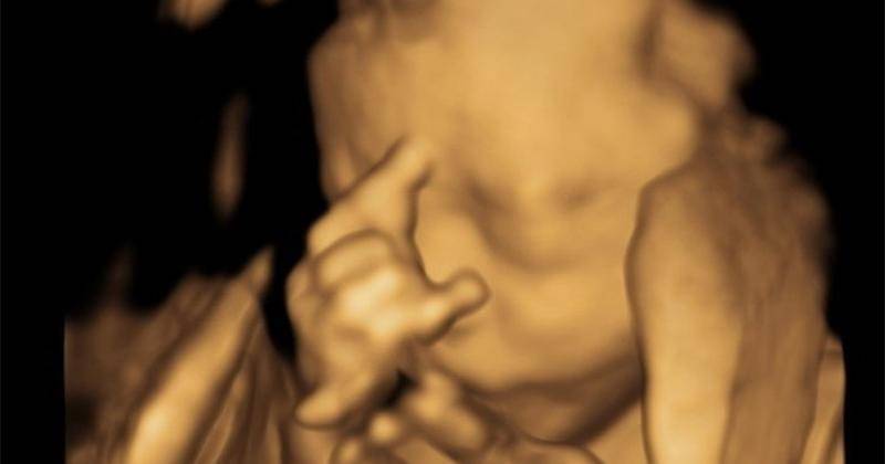 Instagram.com/cutratumeyriska 