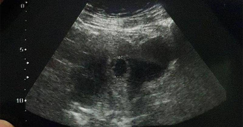 Instagram.com/arsyawijaya21 