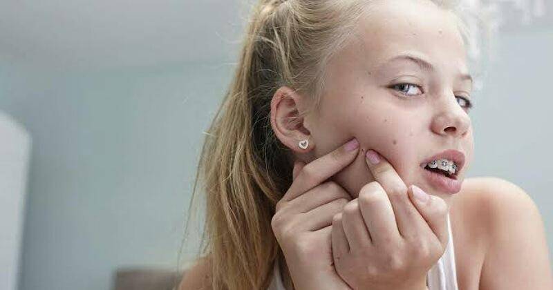 7 Tanda Kulit Tidak Cocok pakai Skincare, Hentikan Pemakaiannya!