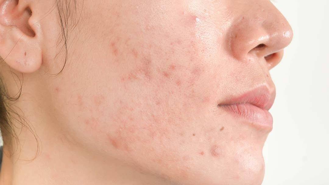 Freepik/sri_sakorn42