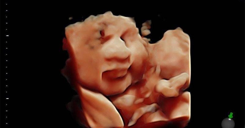 Instagram.com/marcelldarwin  