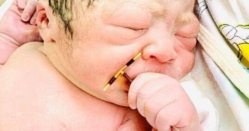 vnexpress.net/Credit to Hai Phong International Hospital