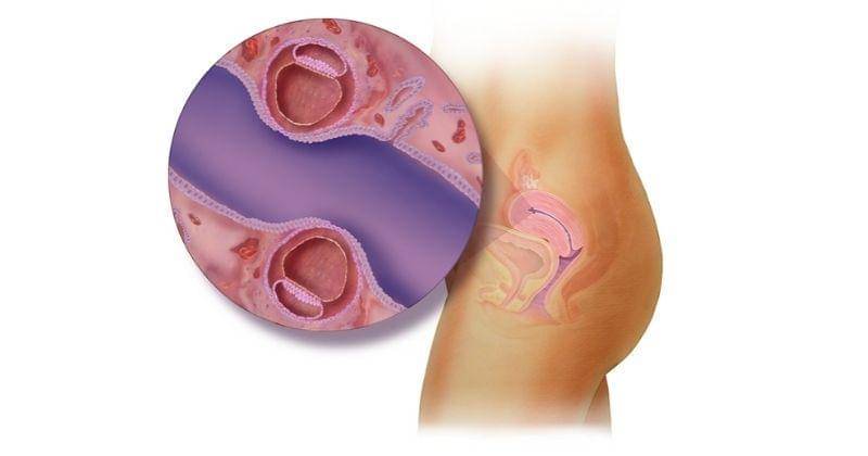 babycenter.com/Peg Gerrity