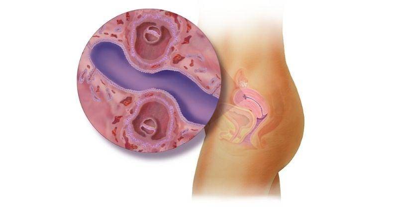 babycenter.com/Peg Gerrity