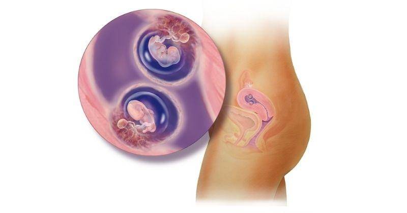 babycenter.com/Peg Gerrity