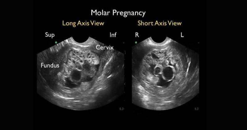 Youtube.com/ WestJEM