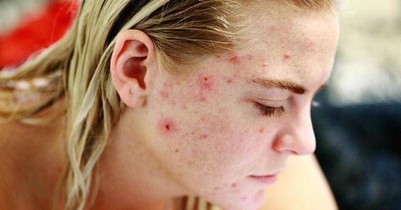 Pixabay/Sharon McCutcheon