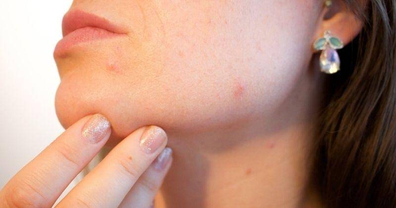 Pixabay/Kjerstin Michaela