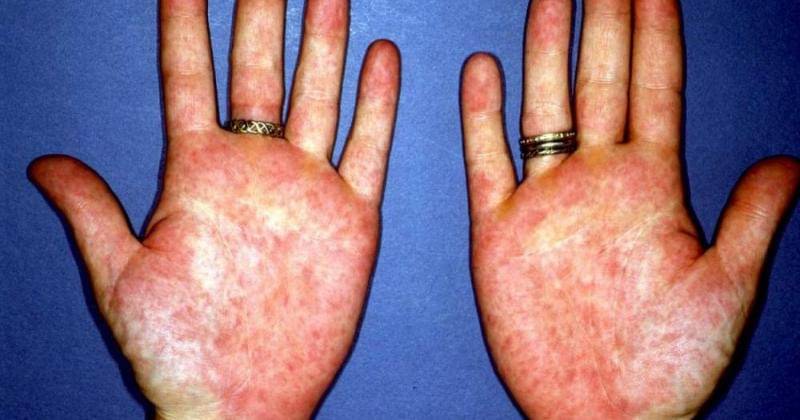 medicalnewstoday.com