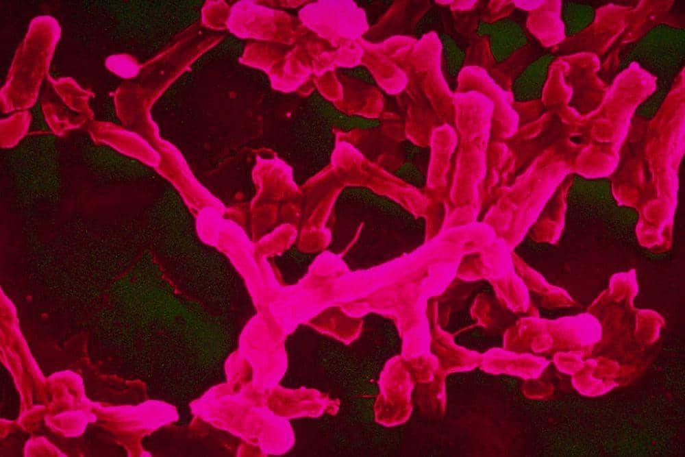 Salmonella, sering dikaitkan dengan telur dan daging yang belum matang