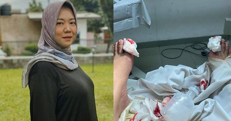 Jalani Operasi Cantengan, Risa Saraswati Minta Ampun karena Kesakitan 