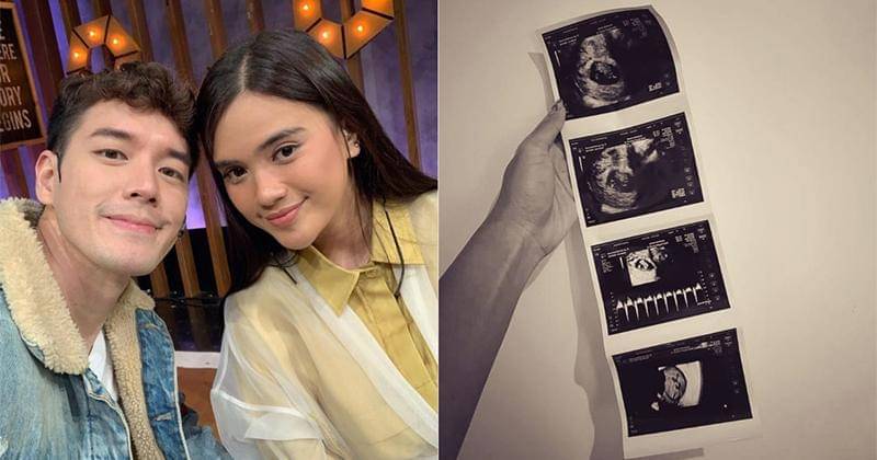 Instagram.com/anthonyxie_