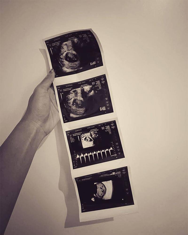 Instagram.com/anthonyxie_