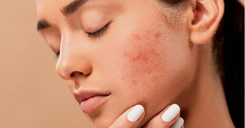 pixabay/josephmucira