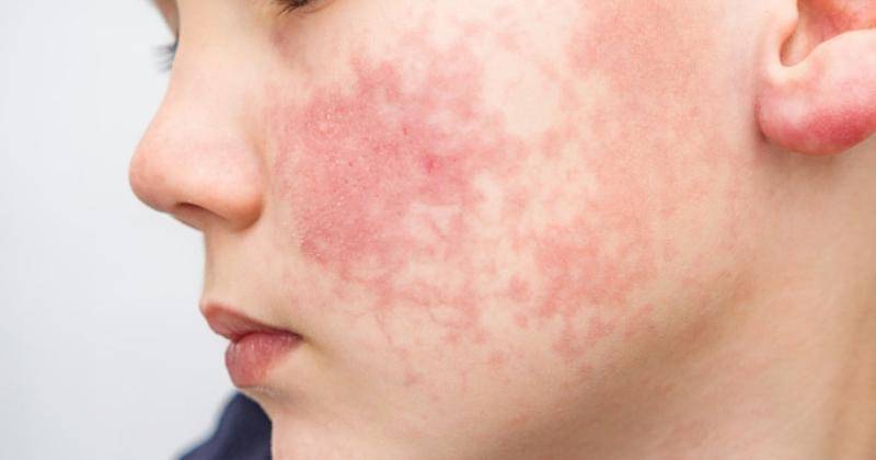 istock/Evgen_Prozhyrko